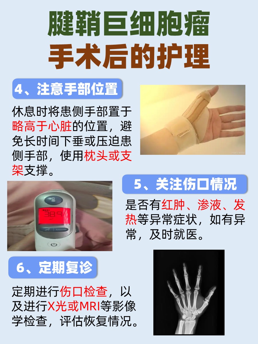 腱鞘巨细胞瘤手术费，你的钱包准备好了吗？