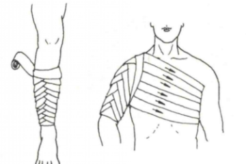 螺旋反折包扎法图 螺旋反折包扎法图