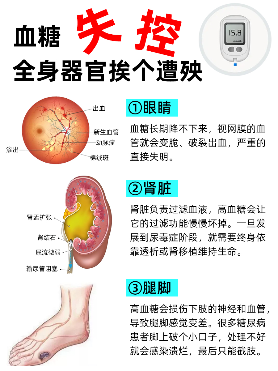 2型糖尿病严重吗？医生把丑话说前头