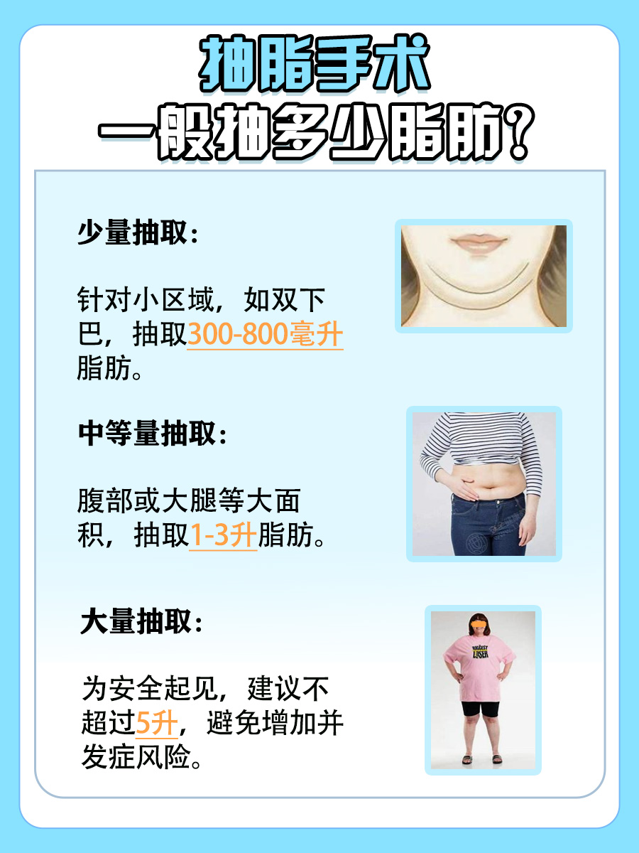 抽脂手术一般抽多少脂肪？医生来为你解答