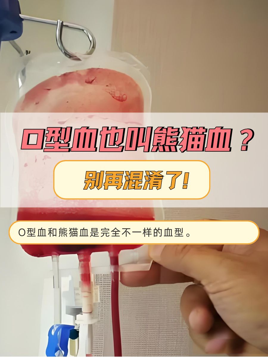 O型血也叫熊猫血?别再混淆了!