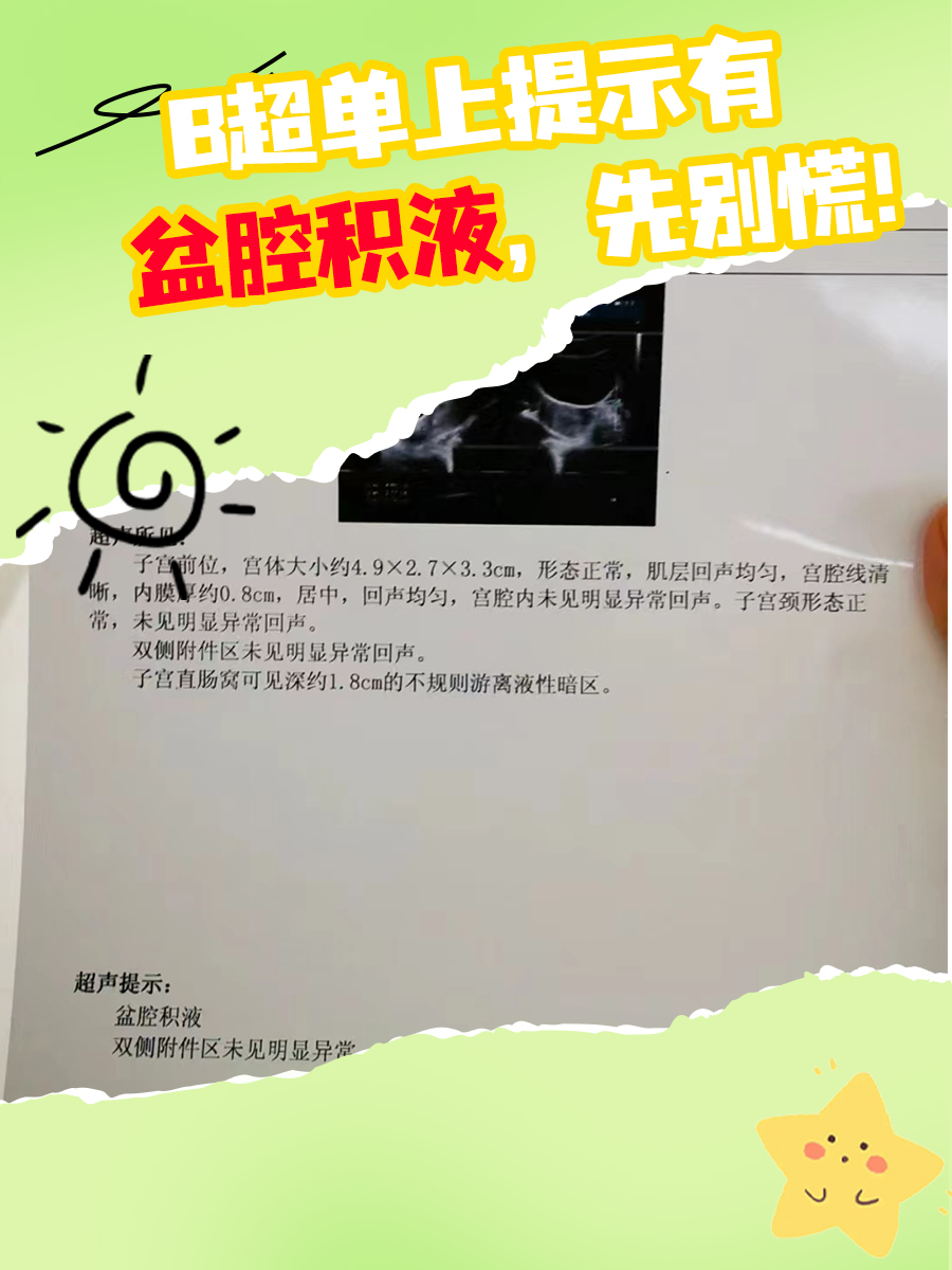 B超单上提示有陶氏腔积液，先别慌！