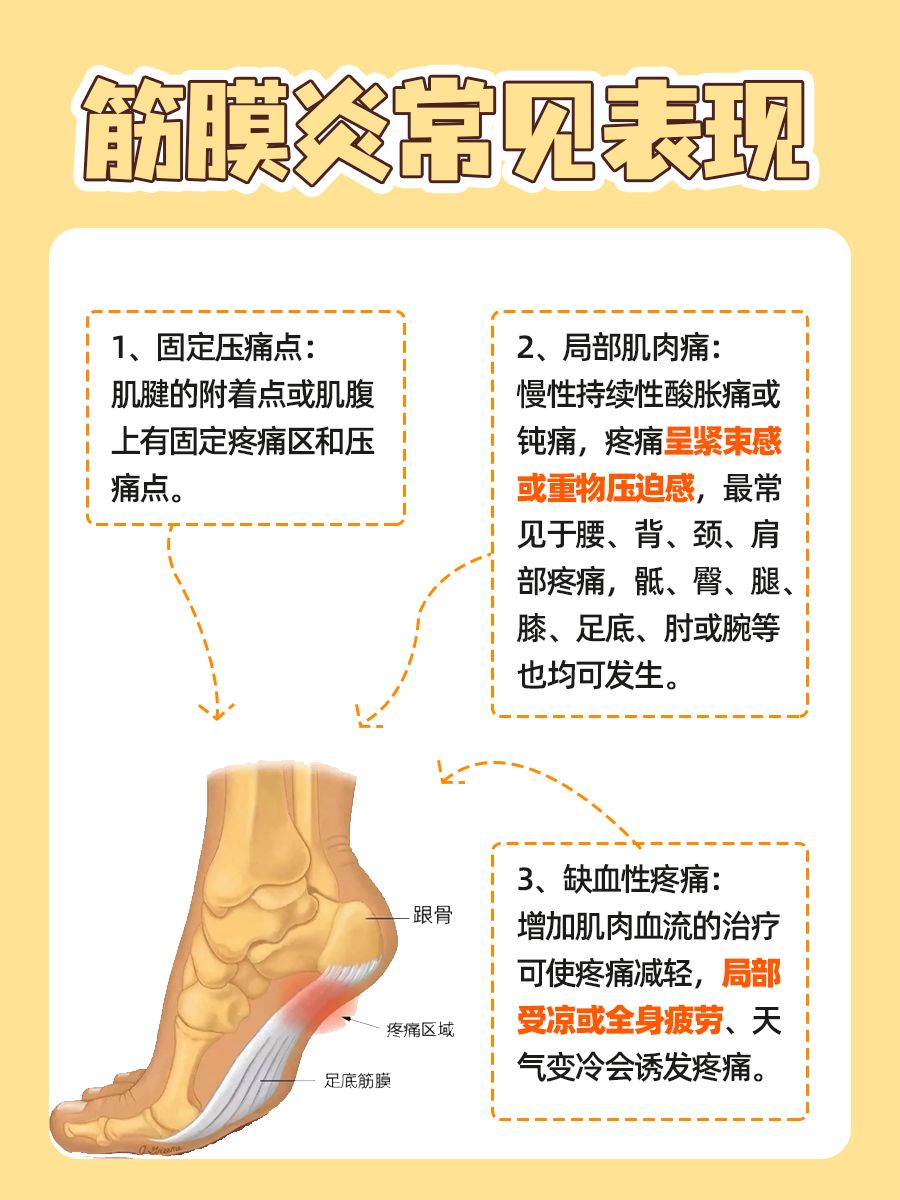 重度筋膜炎多久能好：一文带你解析