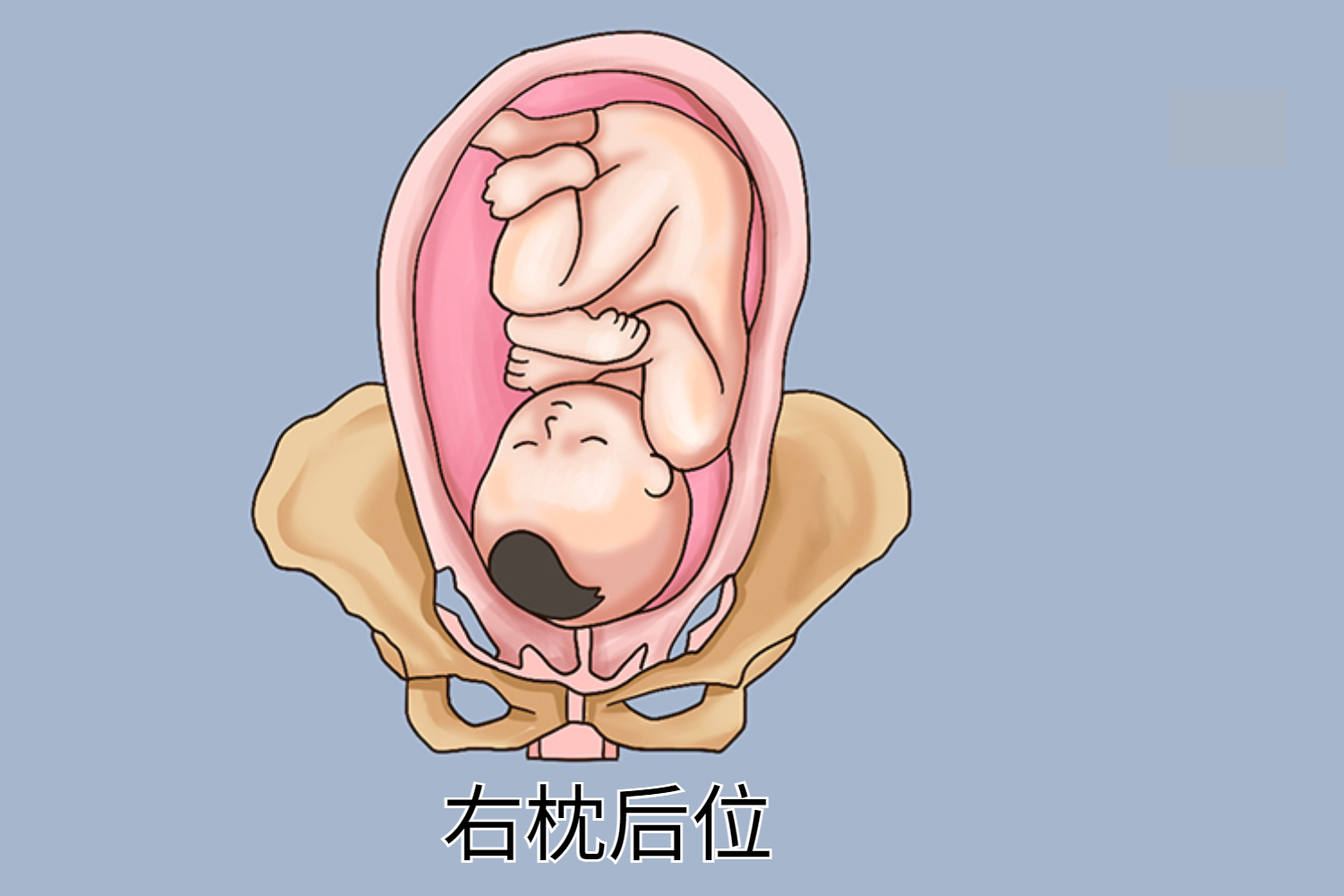 右枕后位图 右枕后位图