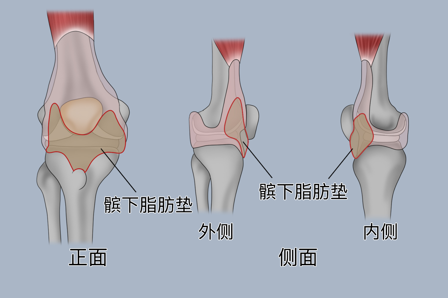 膝盖脂肪垫图片图解图片