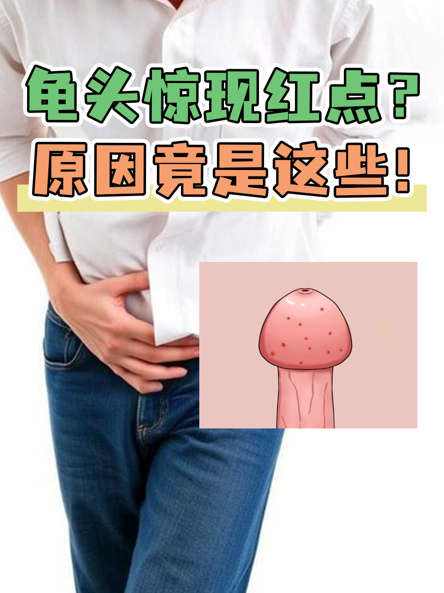 龟头惊现红点？原因竟是这些！