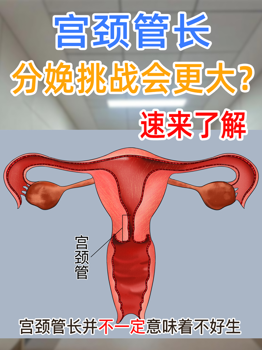宫颈管长，分娩挑战会更大？速来了解