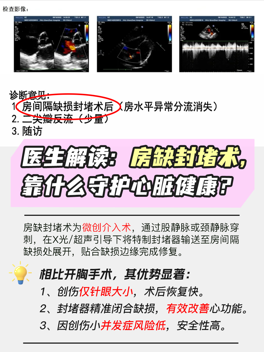 医生解读：房缺封堵术，靠什么守护心脏？