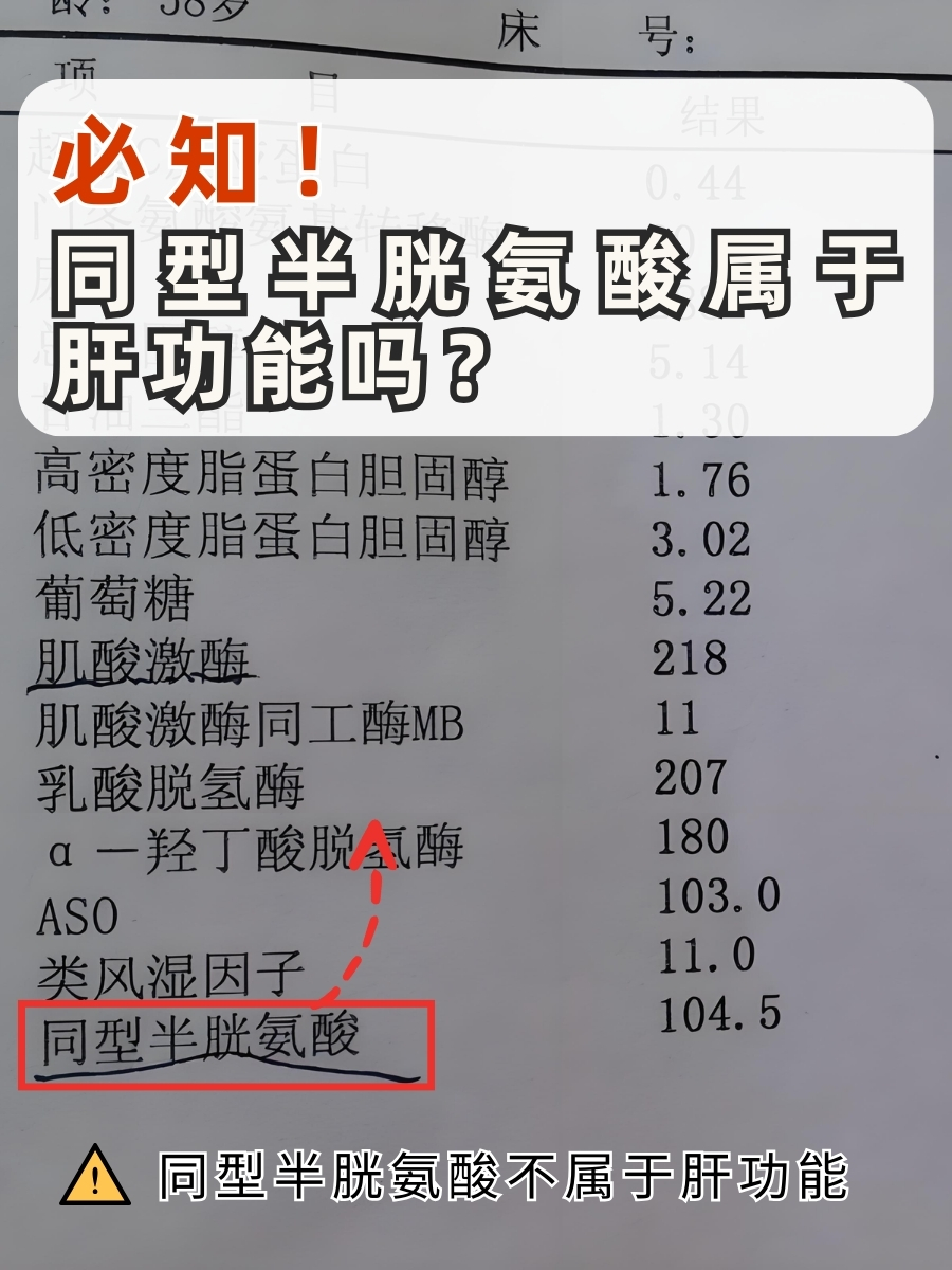 必知!同型半胱氨酸属于肝功能吗?