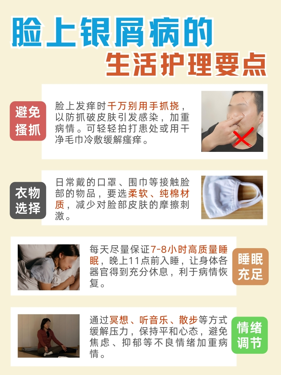 快看!脸银屑病,如何治疗能断根?