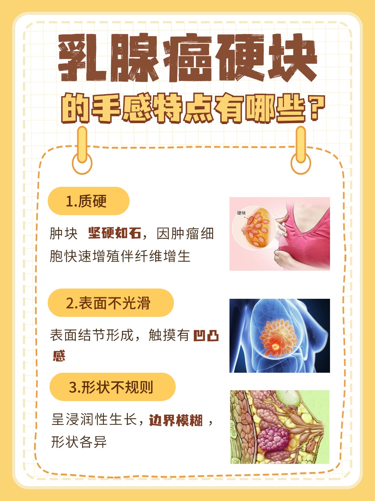 乳腺癌硬块手感特点,医生带你了解