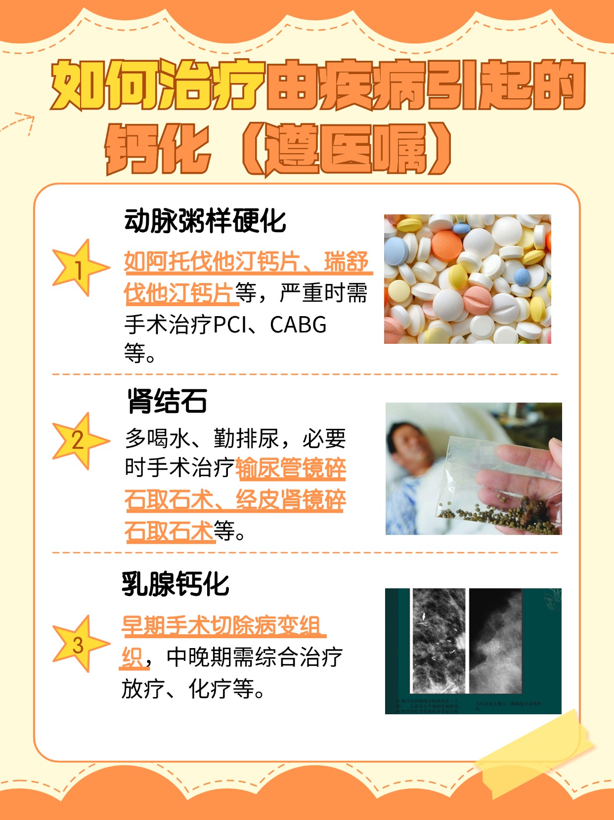 解析：钙化什么意思，严重吗？