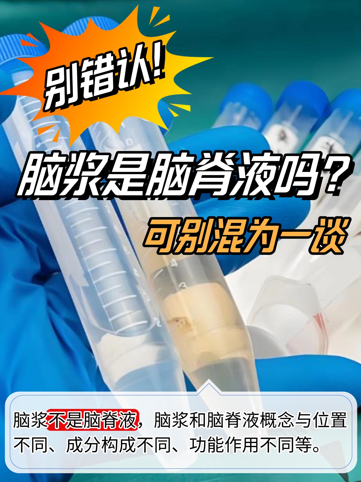 别错认！脑浆是脑脊液吗？可别混为一谈