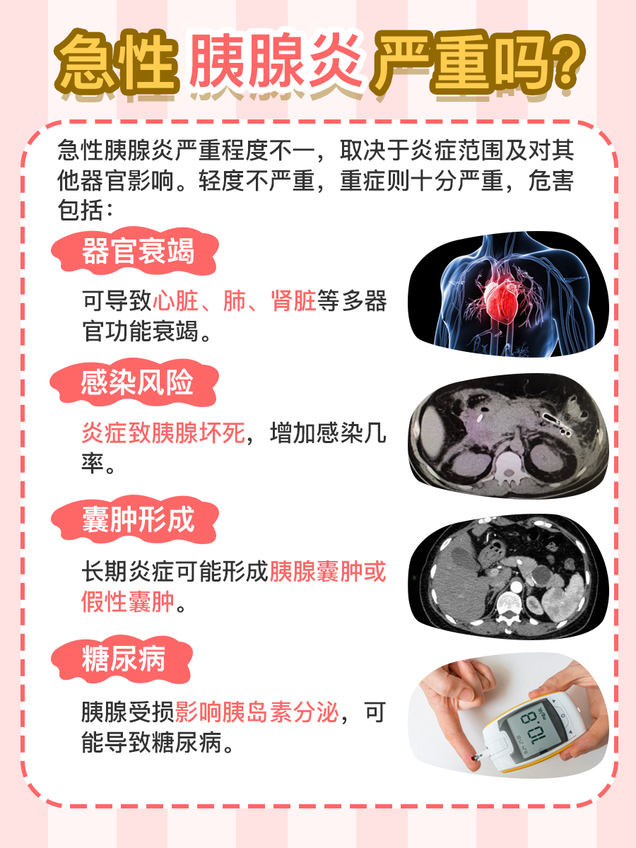 急性胰腺炎严重吗？医生为你详细解答