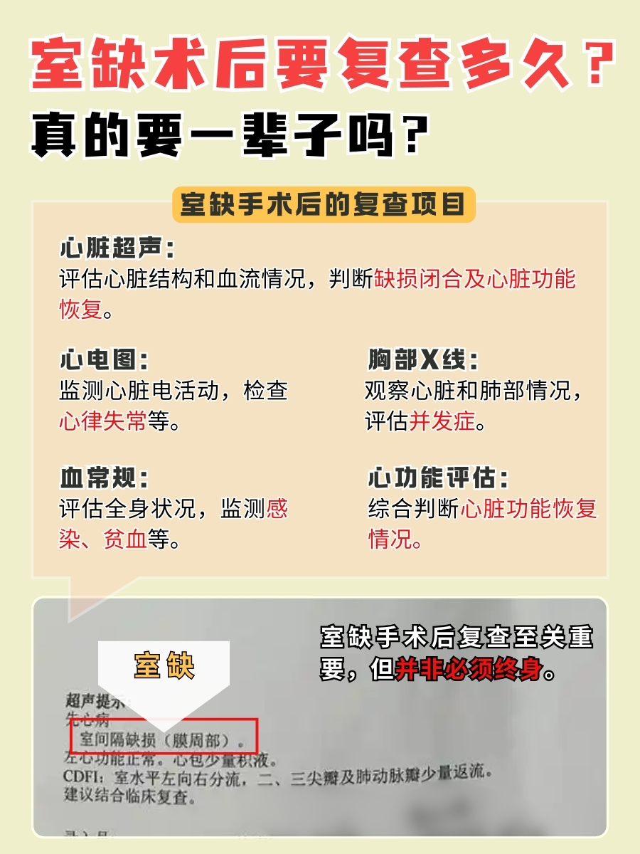 室缺术后要复查多久？真的要一辈子吗？