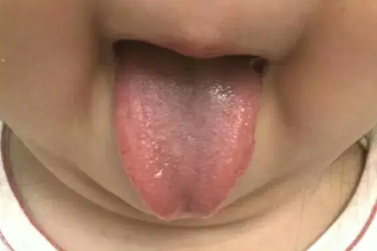 四个月宝宝正常舌苔图