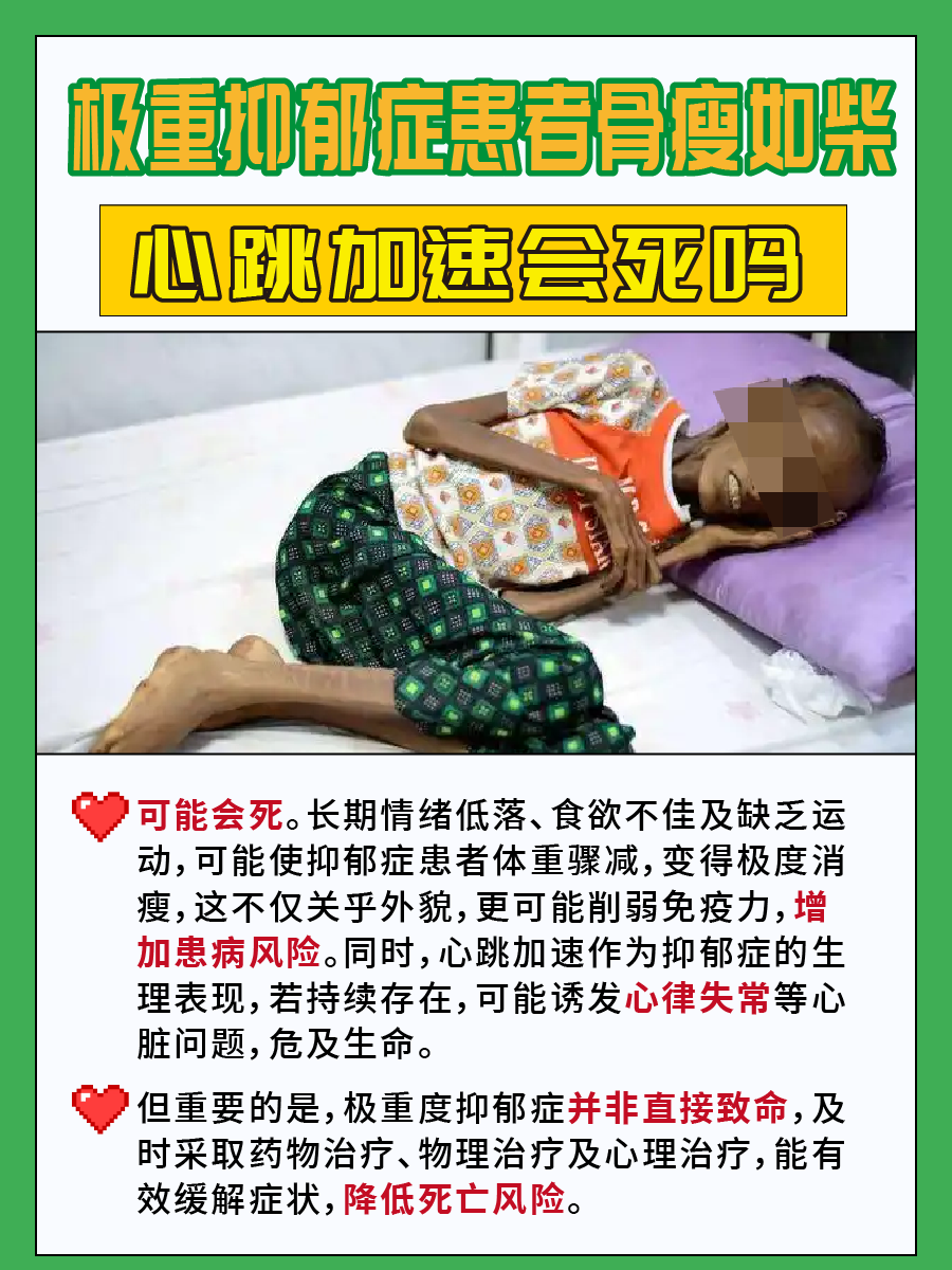 极重抑郁症:骨瘦如柴,心跳加速,在生死边缘?