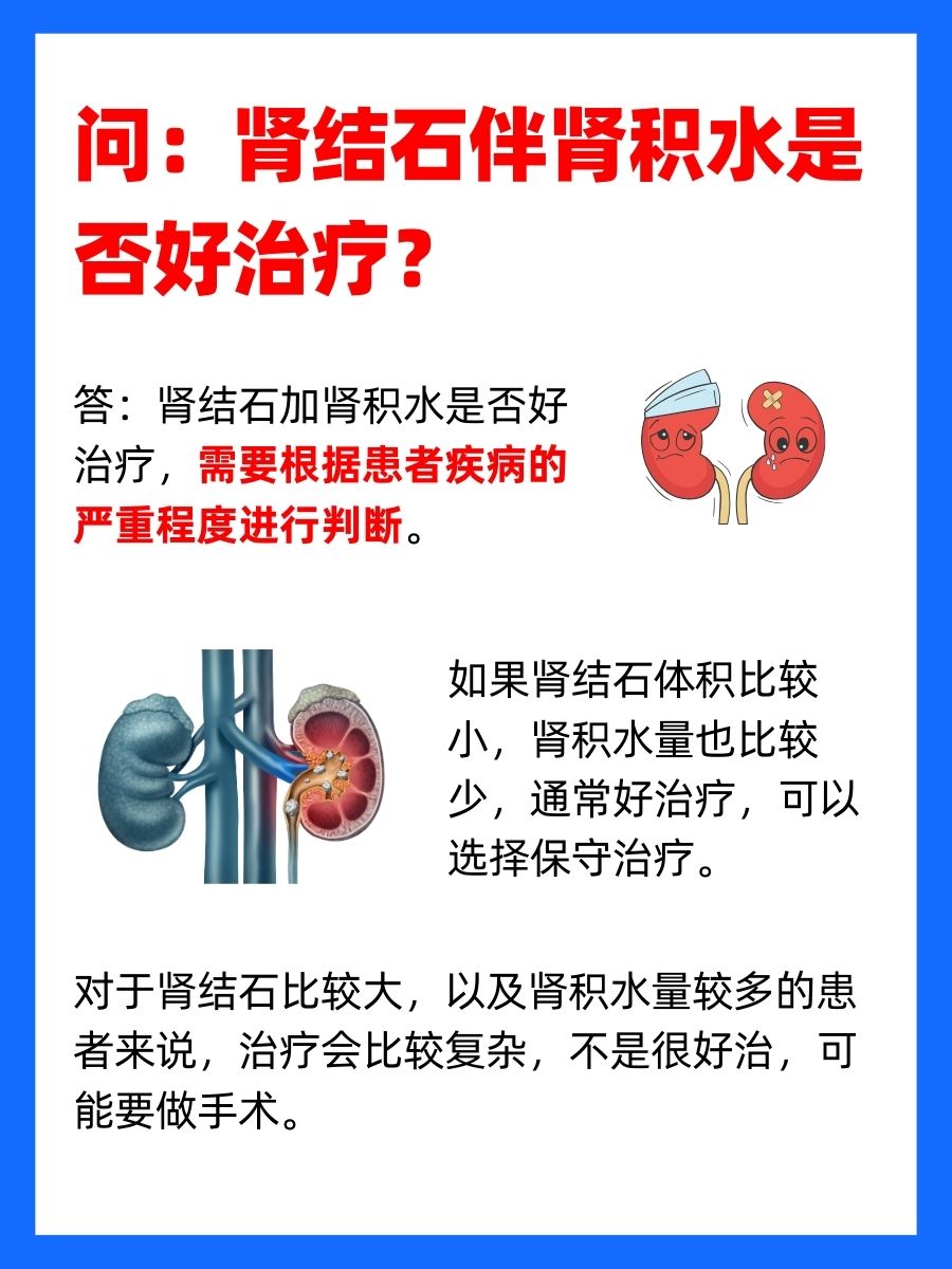 肾结石伴肾积水，是否好治疗