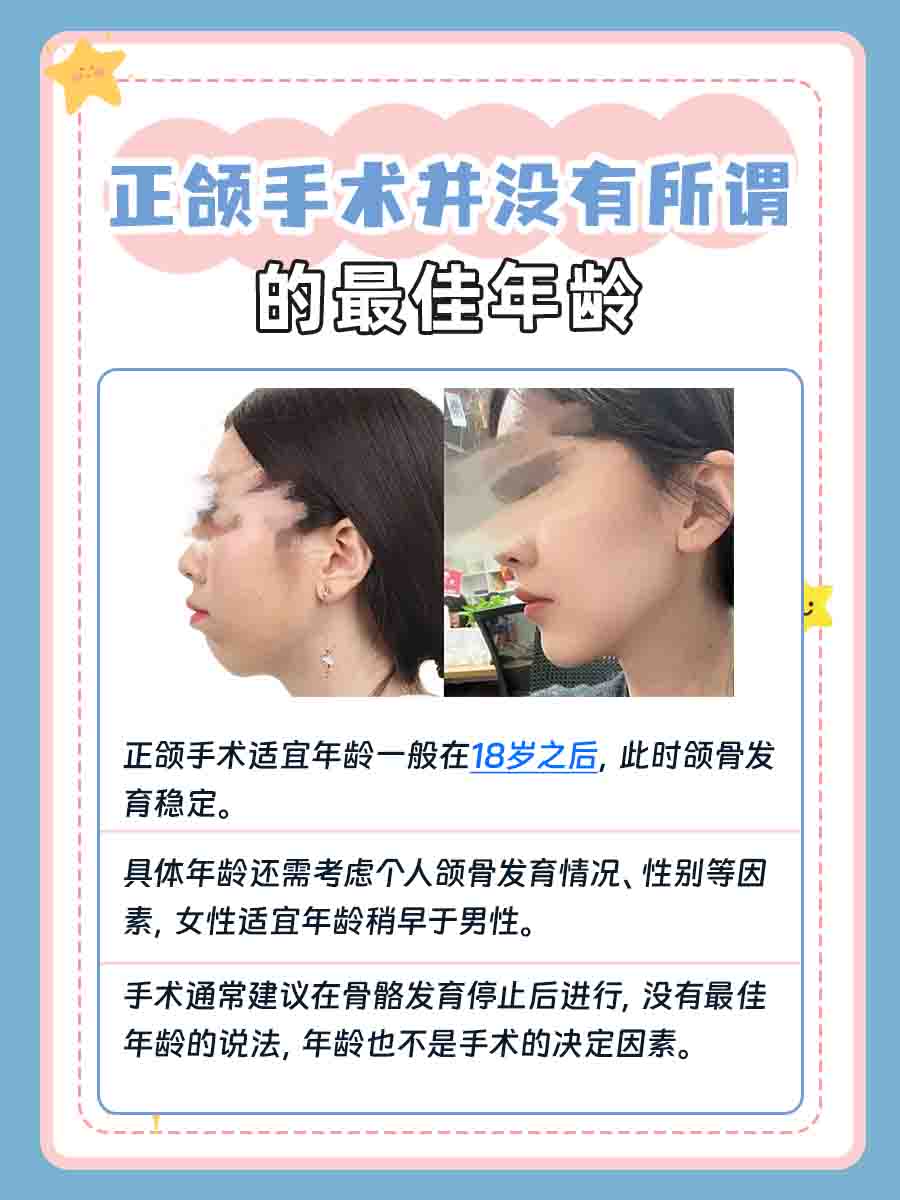 辟谣！正颌手术有最佳年龄？