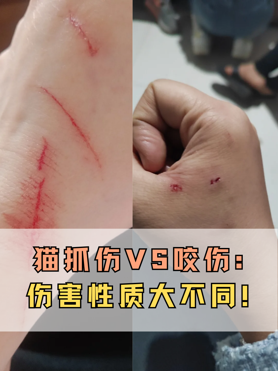 猫抓伤VS咬伤：伤害性质大不同！