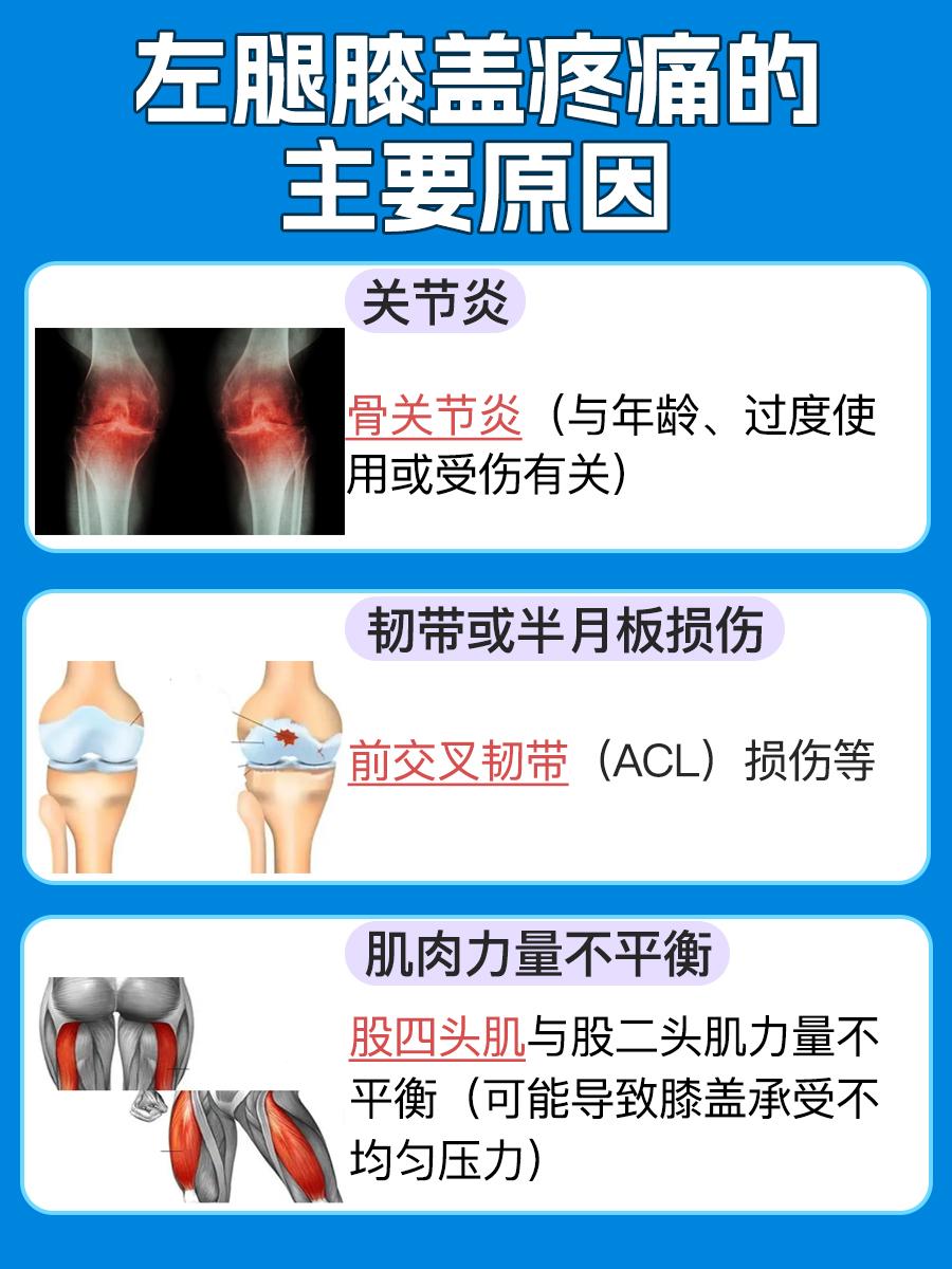 左膝疼痛：原因分析与治疗策略