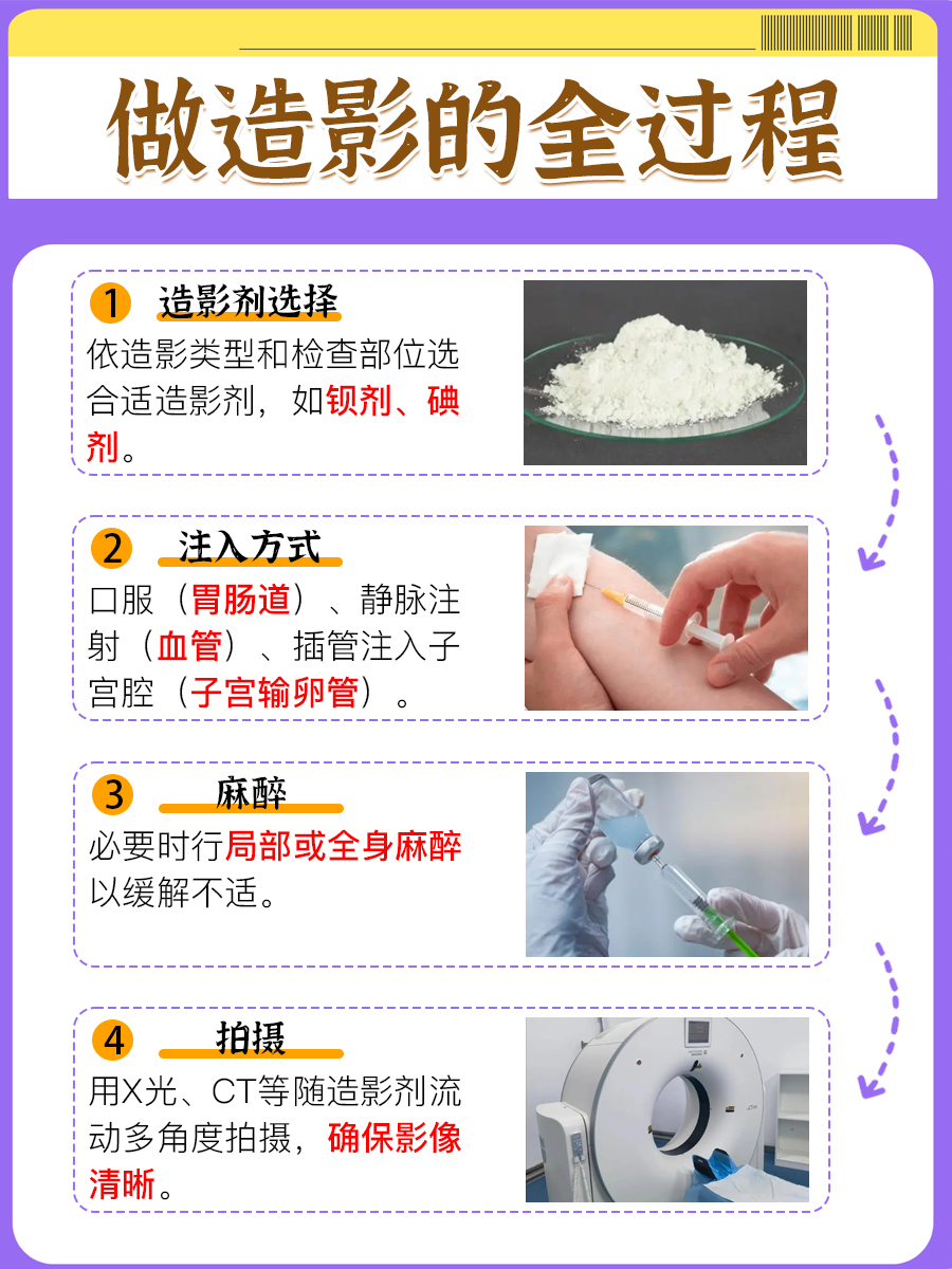 做造影的全过程：这篇文章让你看懂