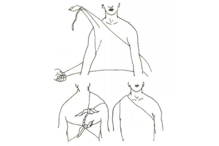 胸背部包扎法图 胸背部包扎法图