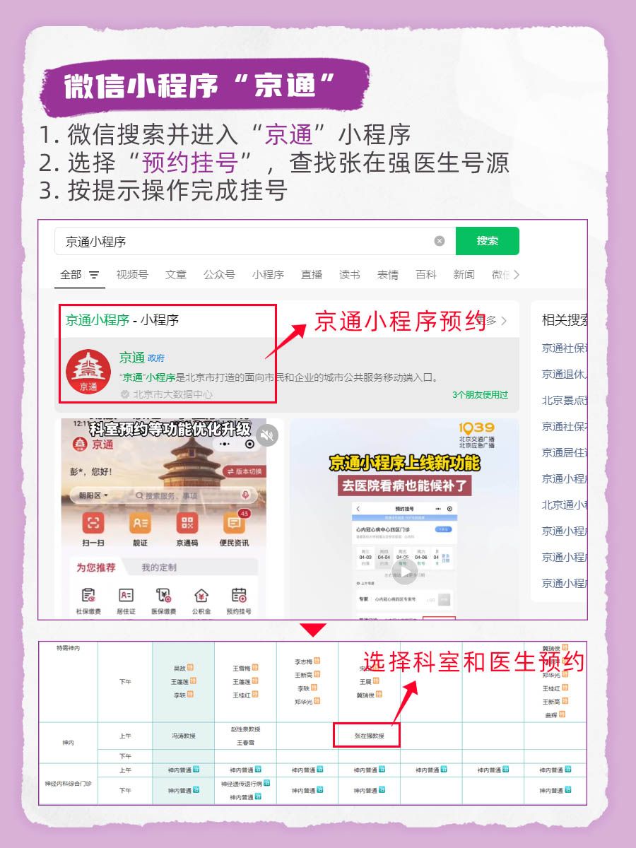 北京天坛医院张在强医生怎么样?怎么挂号?