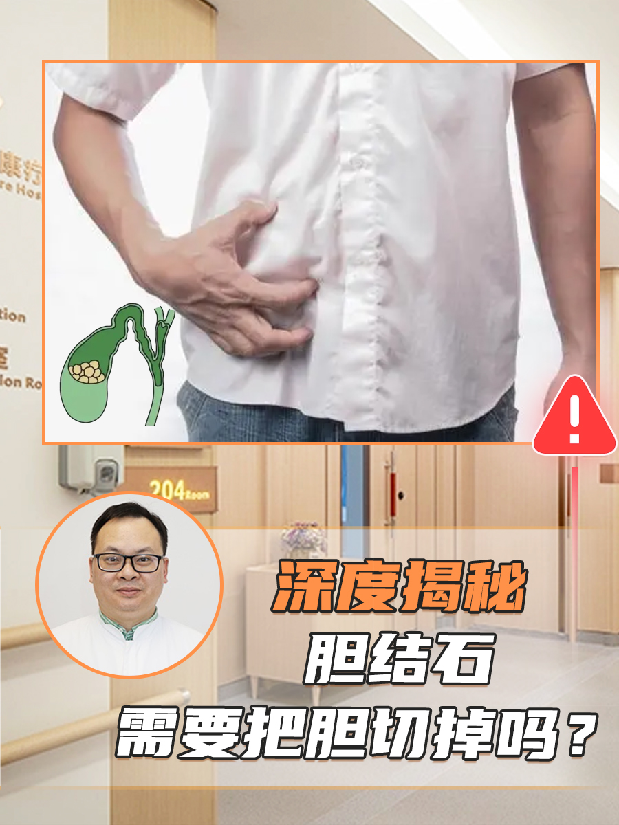 深度揭秘：胆结石需要把胆切掉吗？