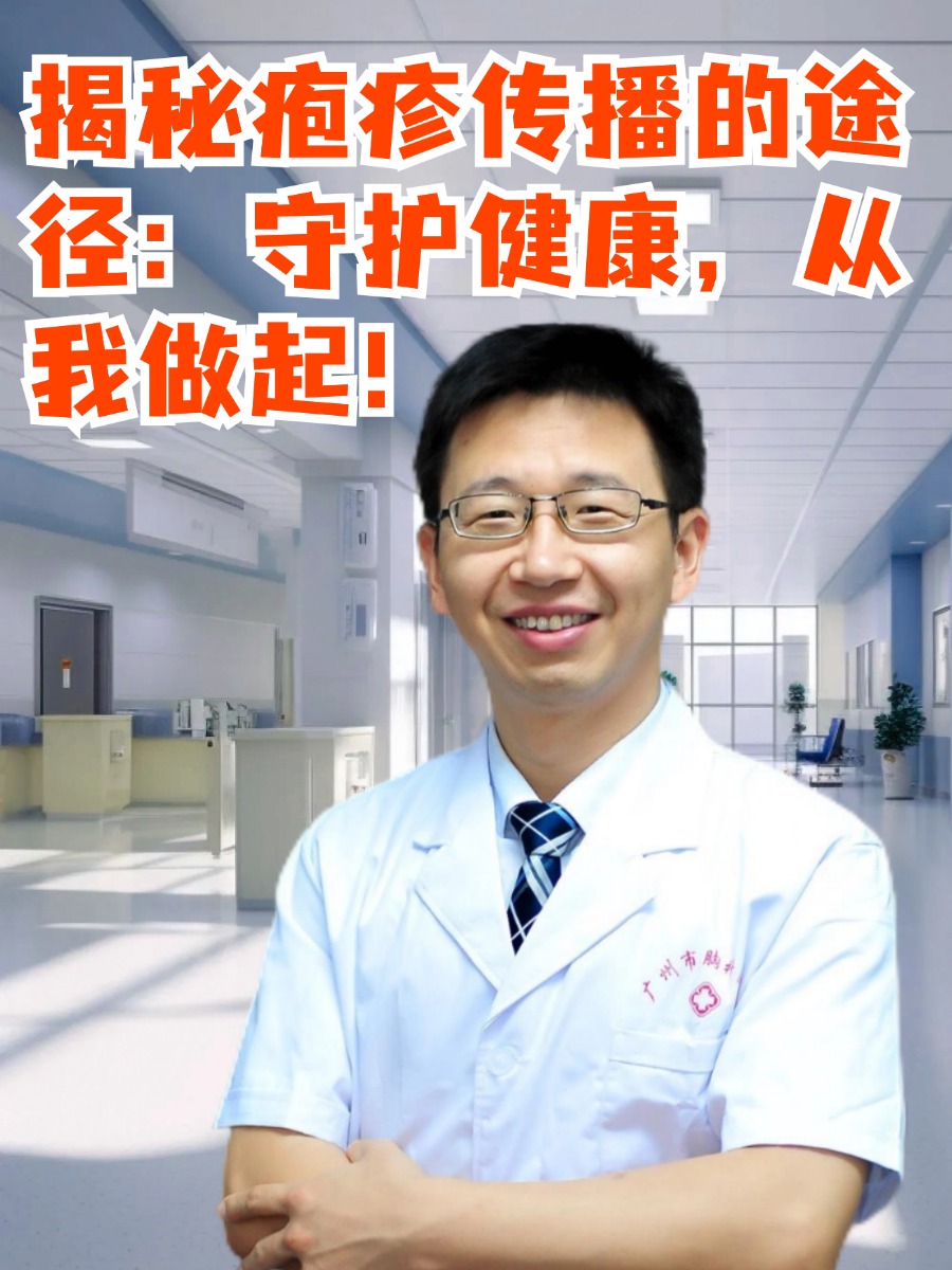 揭秘疱疹传播的途径:守护健康,从我做起!