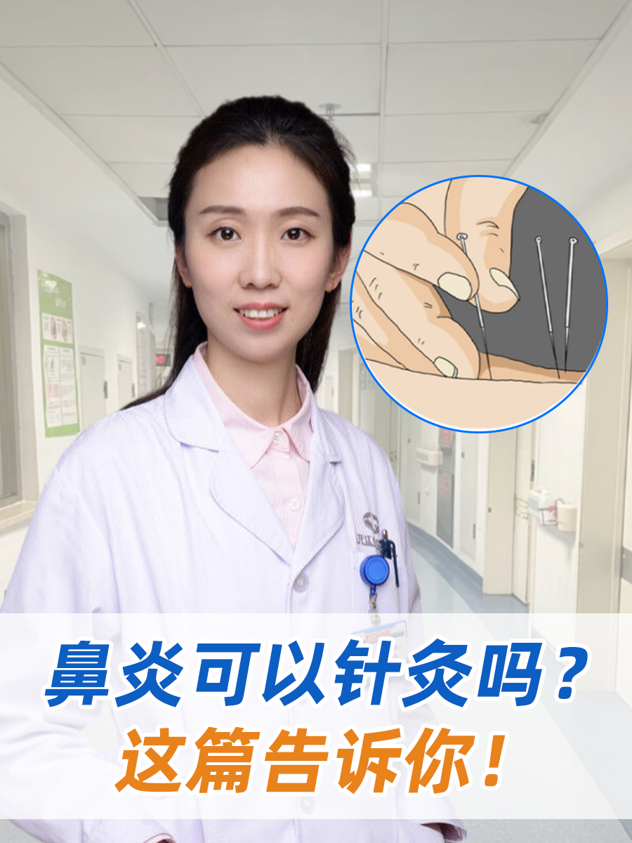 鼻炎可以针灸吗?这篇告诉你!