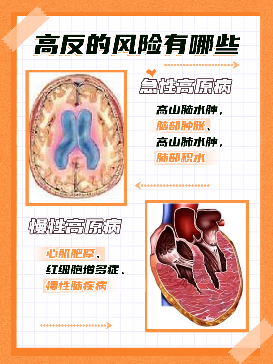 高原反应：为何躺下休息反而感觉更加不适