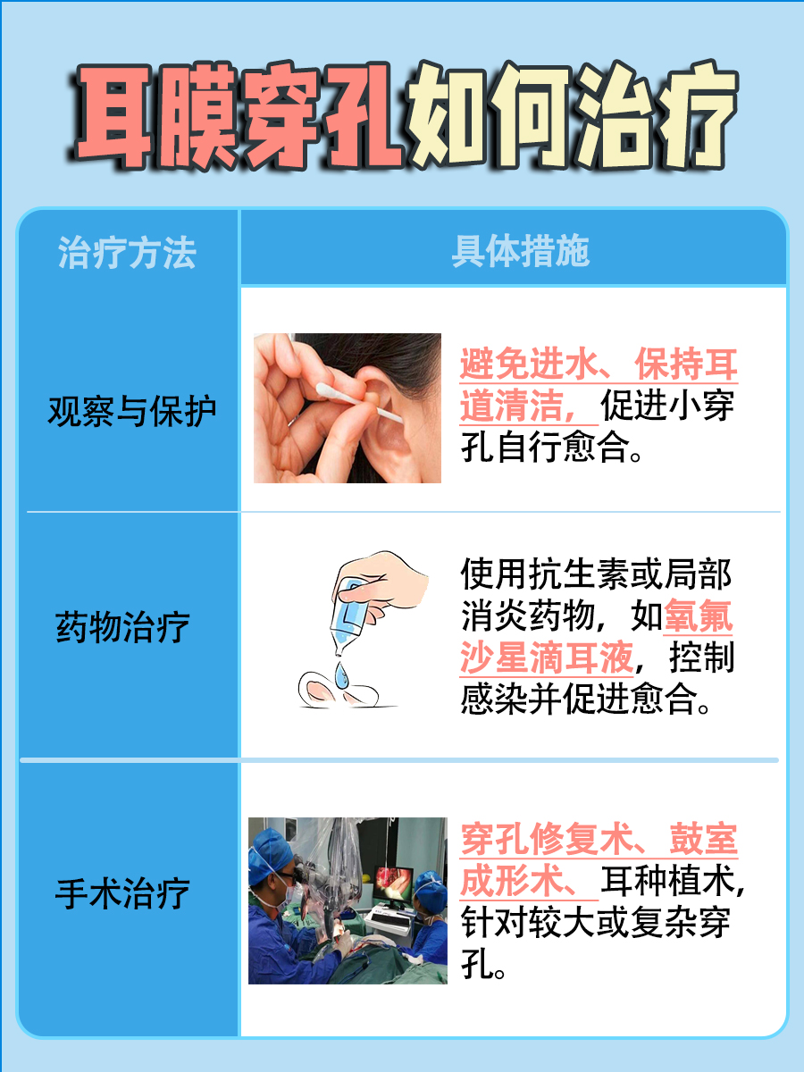 耳膜穿孔是什么症状?一文解析