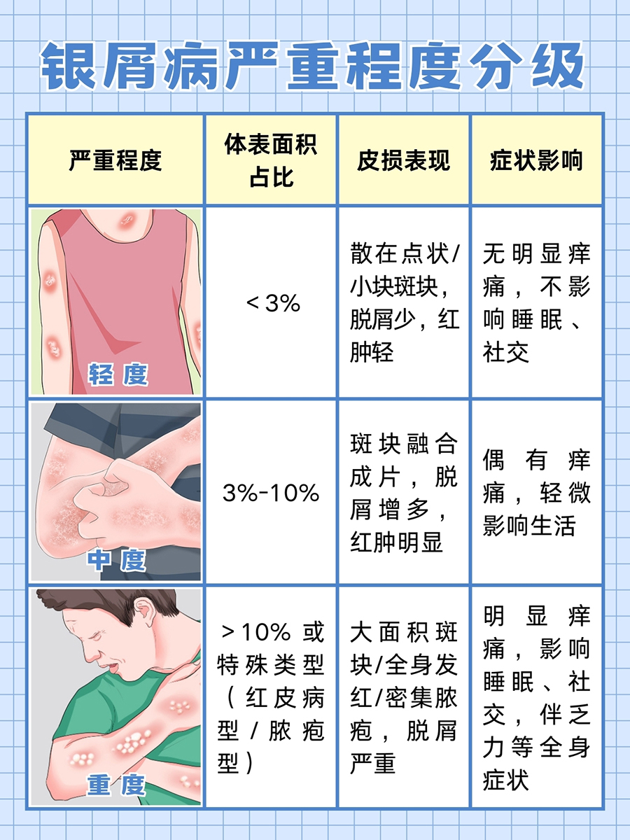 银屑病最好的治疗方案,医生解答!