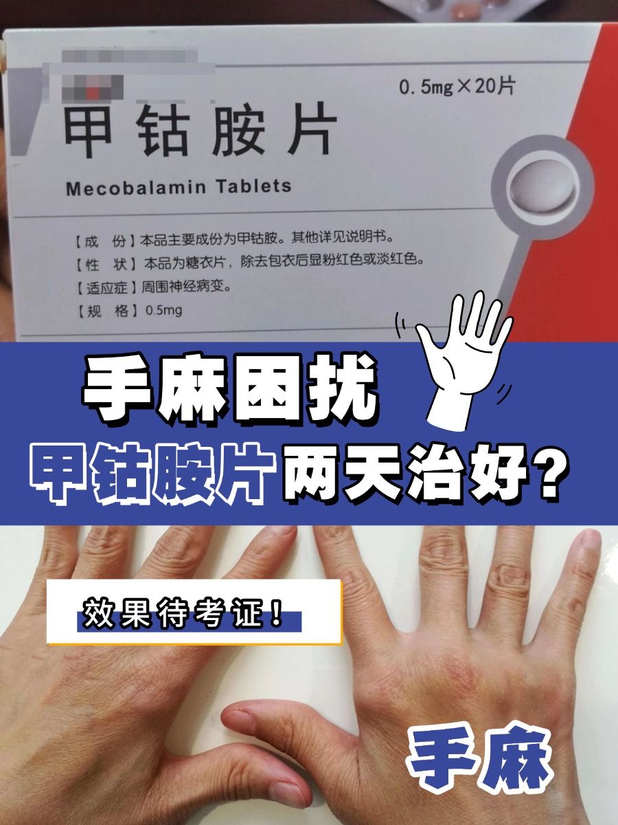 手麻困扰，甲钴胺片两天治好？效果待考证！