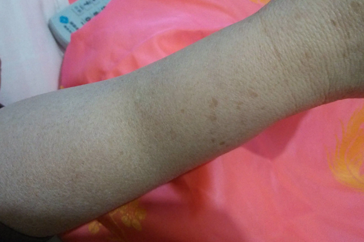 手臂周径缩小图 手臂周径缩小图