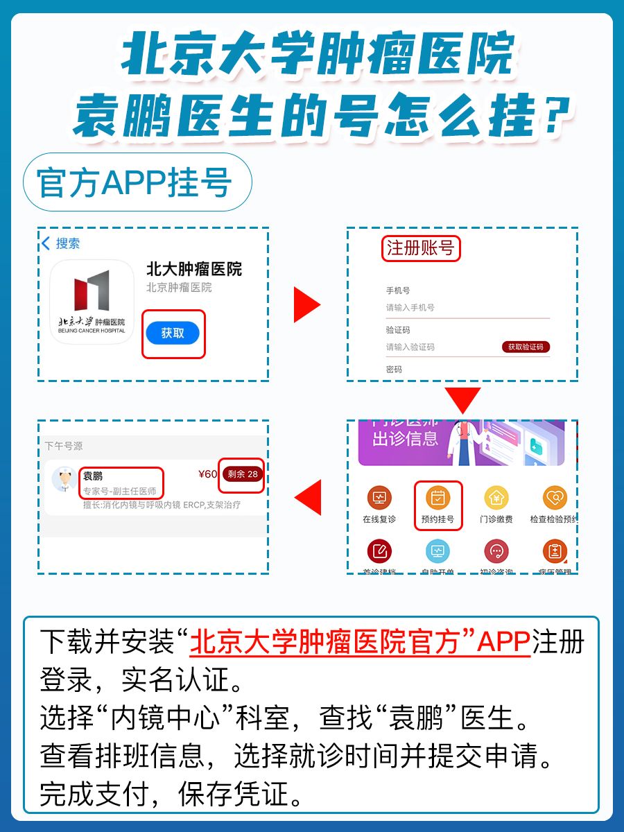北京大学肿瘤医院袁鹏医生怎么样?怎么挂号?