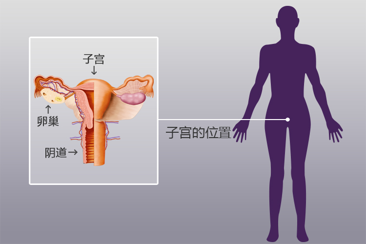 宫腔位置图