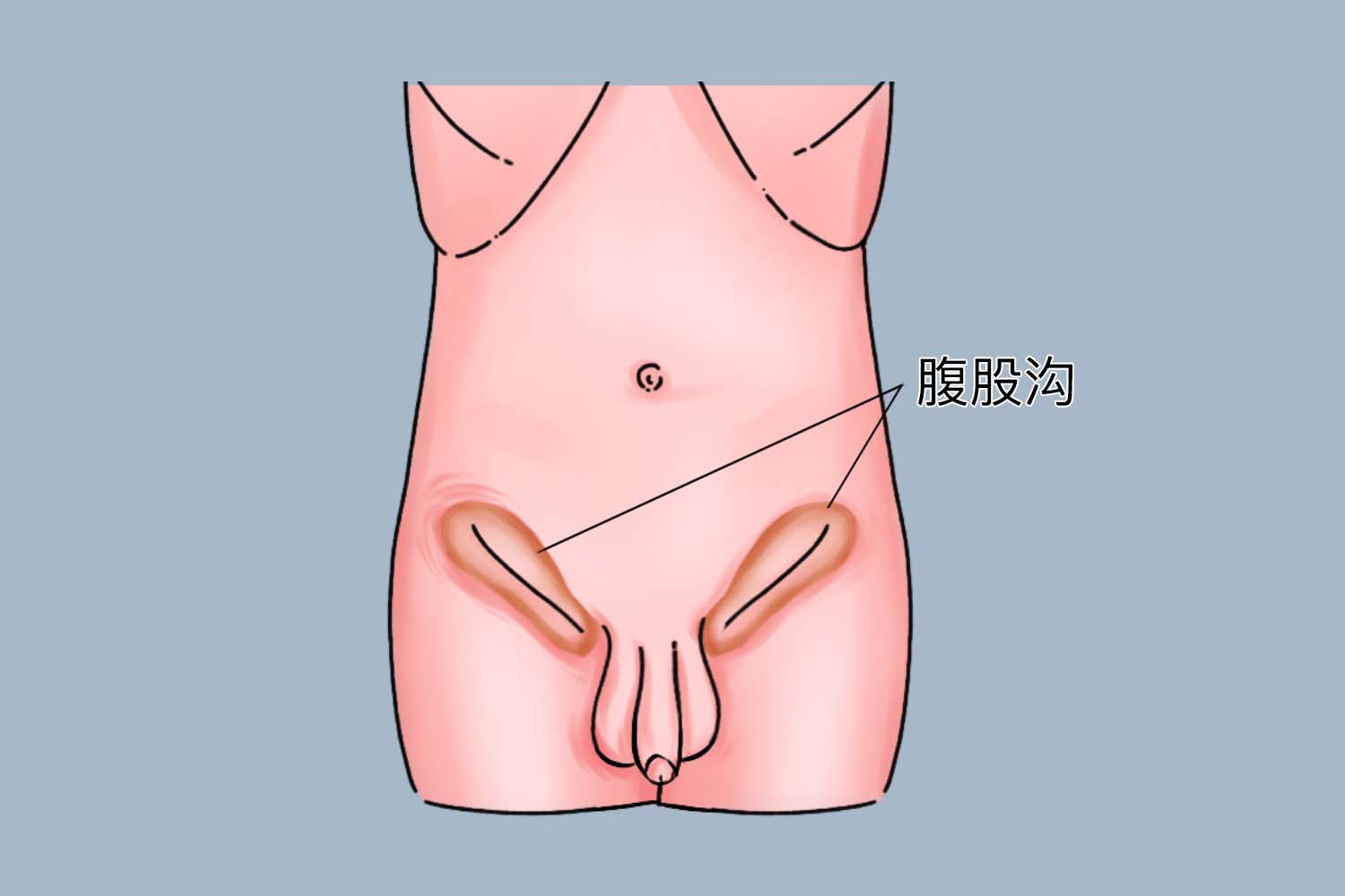 宝宝腹股沟位置图