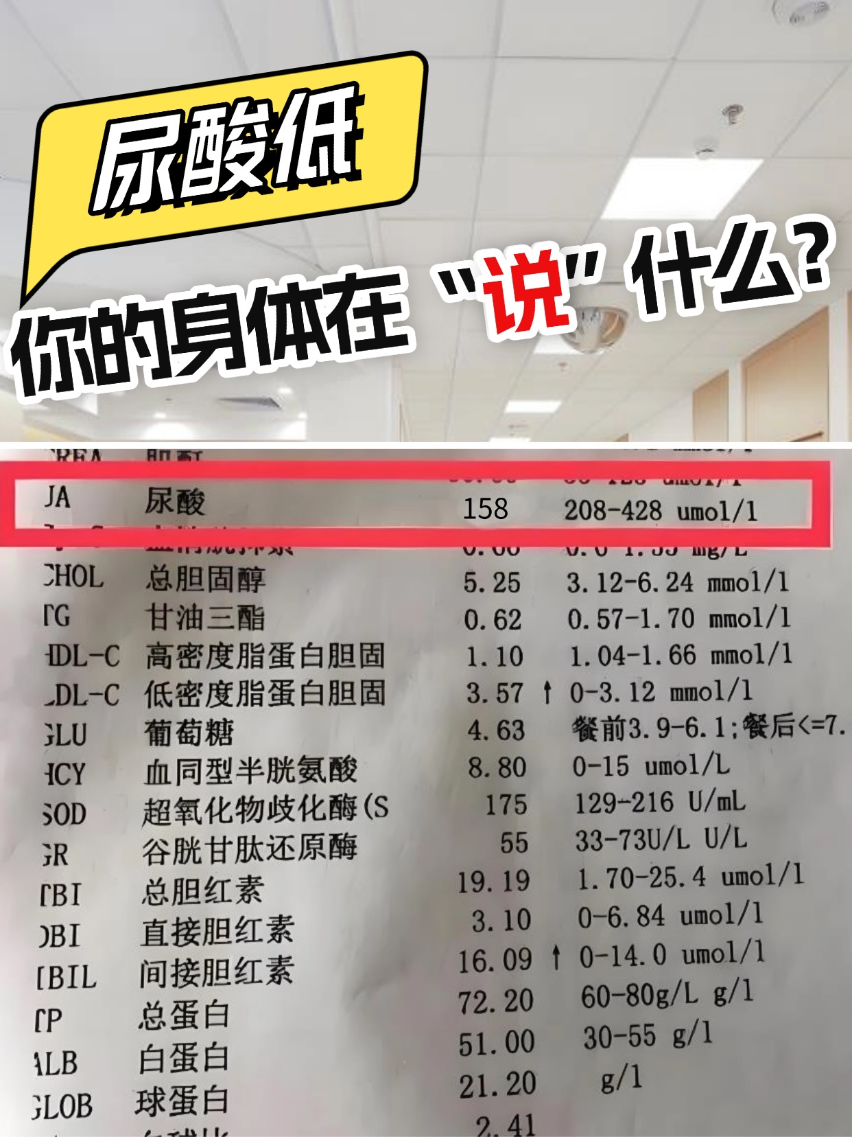 尿酸低,你的身体在“说”什么?