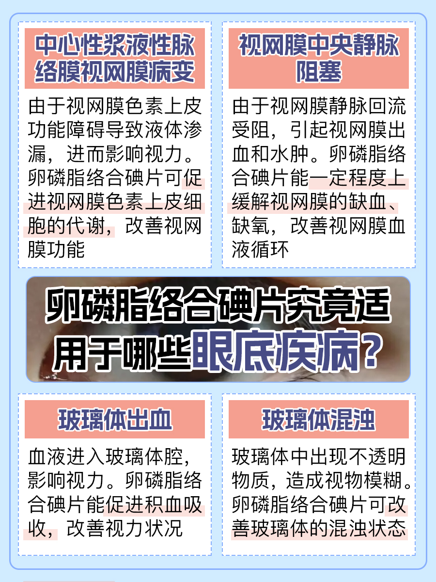 卵磷脂络合碘片，能否治愈眼底病变？