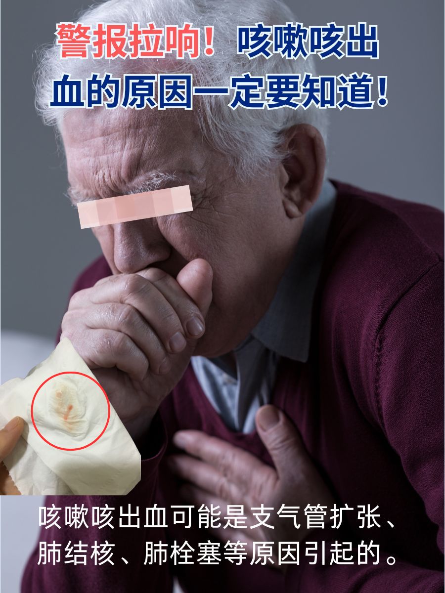 警报拉响!咳嗽咳出血的原因一定要知道!