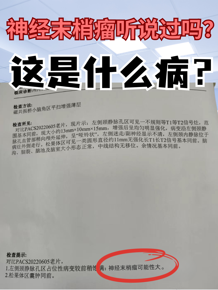 神经末梢瘤听说过吗?这是什么病?