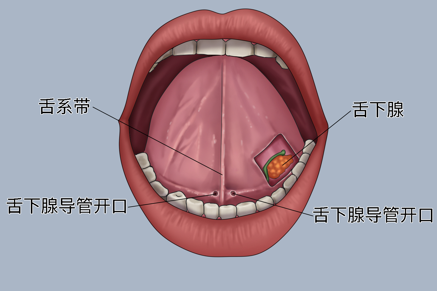 舌下腺为混合腺体,在口底黏膜舌下皱襞的深面,下颌舌骨肌以上