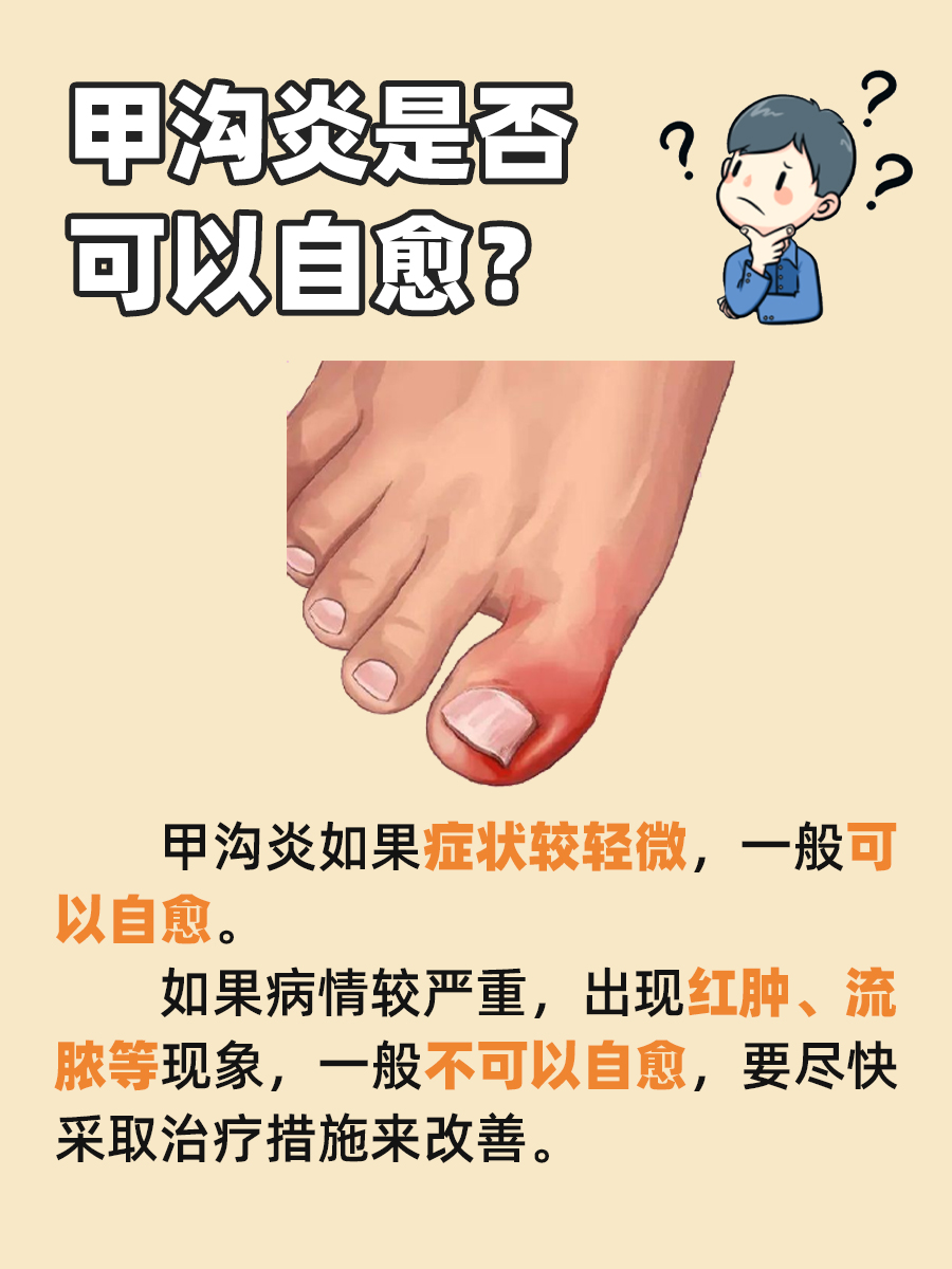 甲沟炎能自愈吗？医生答案来了