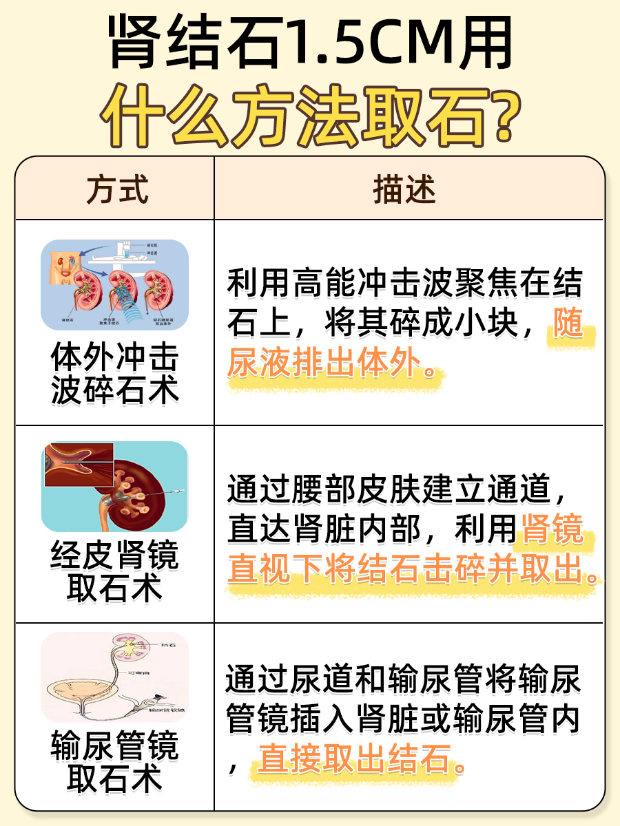 肾结石1.5cm,专业取石术还你轻松