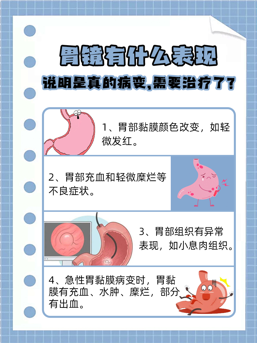 胃窦发白，是病变征兆还是正常变化？