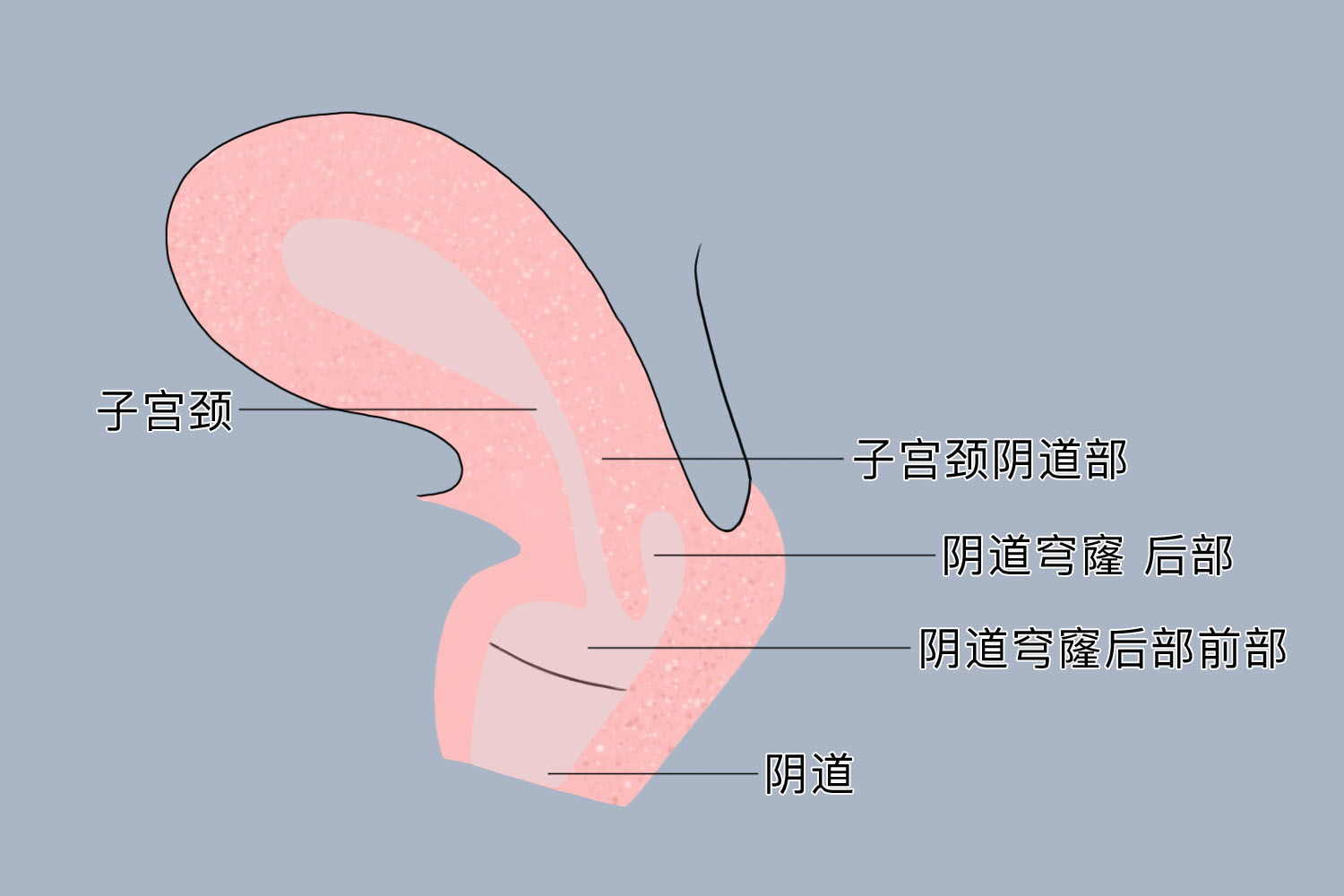 下穹窿部位是哪里图片图片