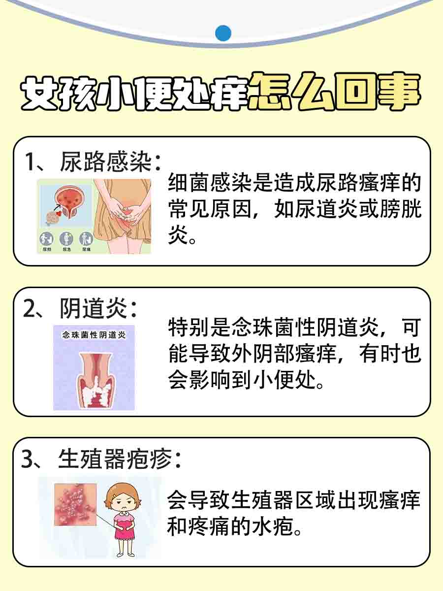 女性小便处瘙痒？可能原因及应对策略