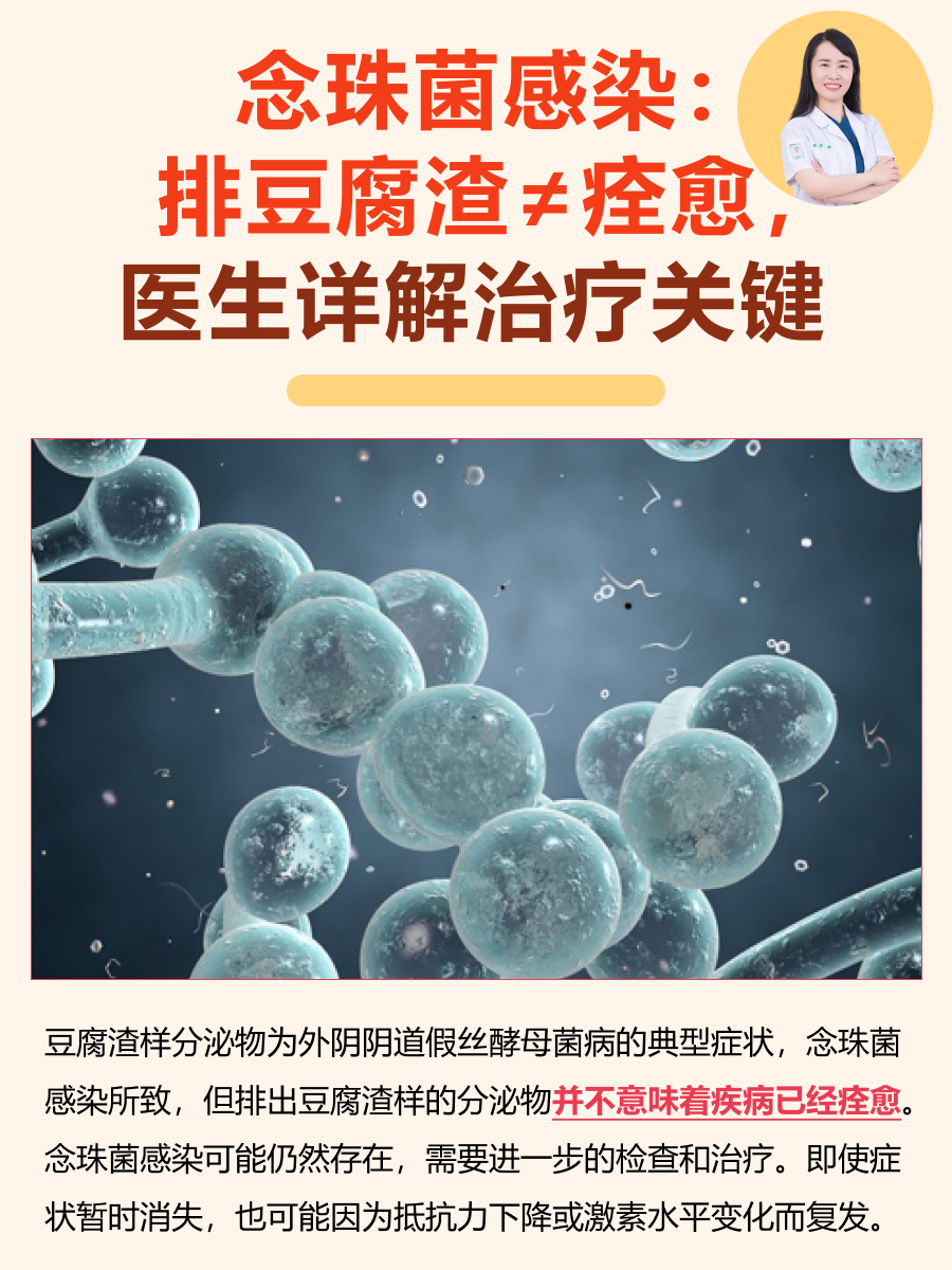 念珠菌感染：排豆腐渣≠痊愈，医生详解治疗关键